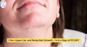Chin, Upper Lip, and Body Hair Growth – Is It a Sign of PCOD?